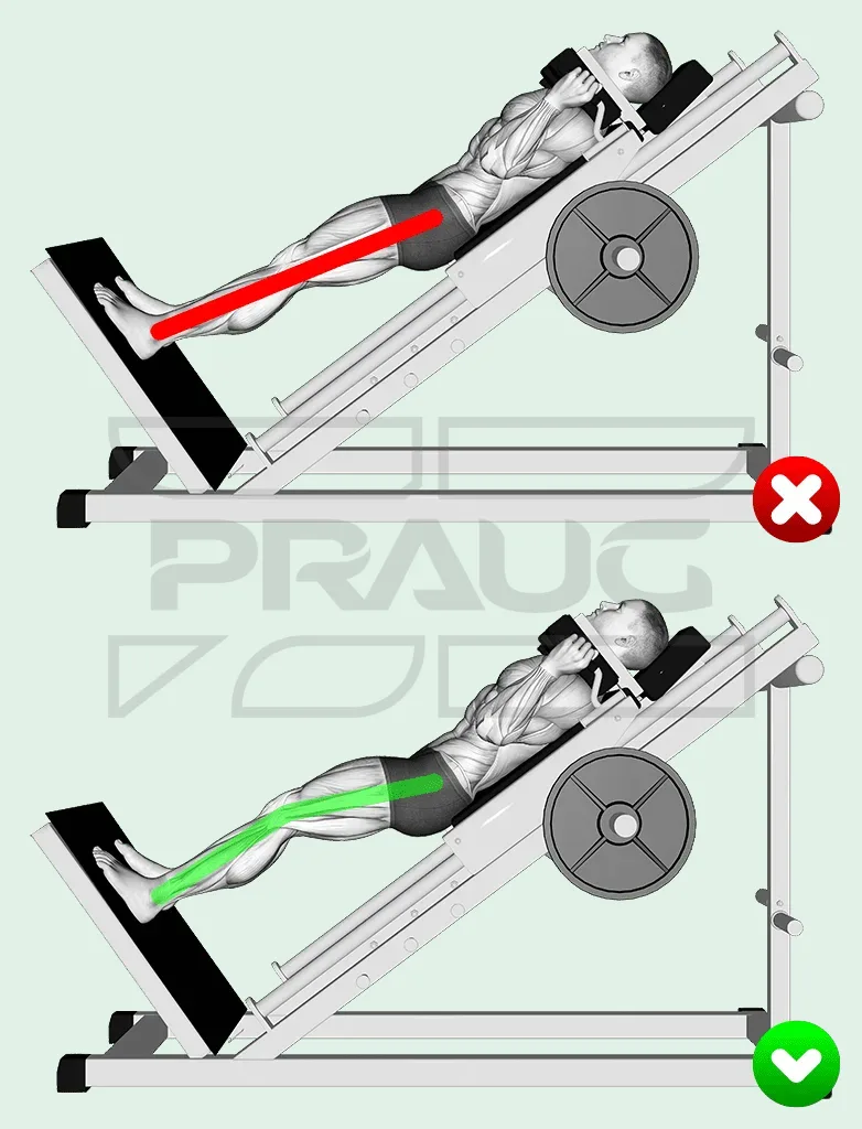 Deux illustrations du hack squat en position haute : en haut, jambes verrouillées marquées d’une croix rouge ; en bas, genoux légèrement fléchis marqués d’une coche verte.